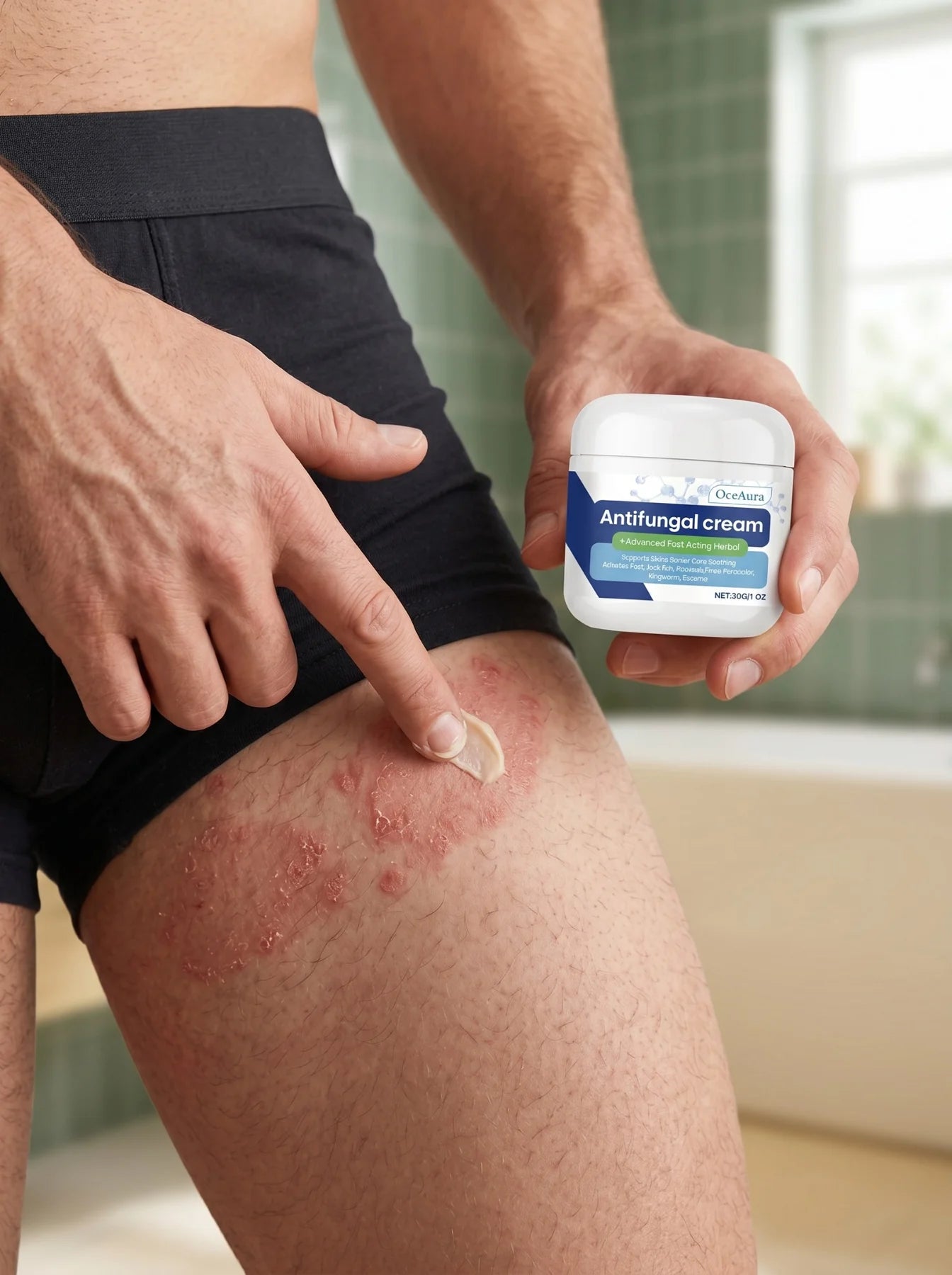 Applying ATEM cream to a high-friction thigh area